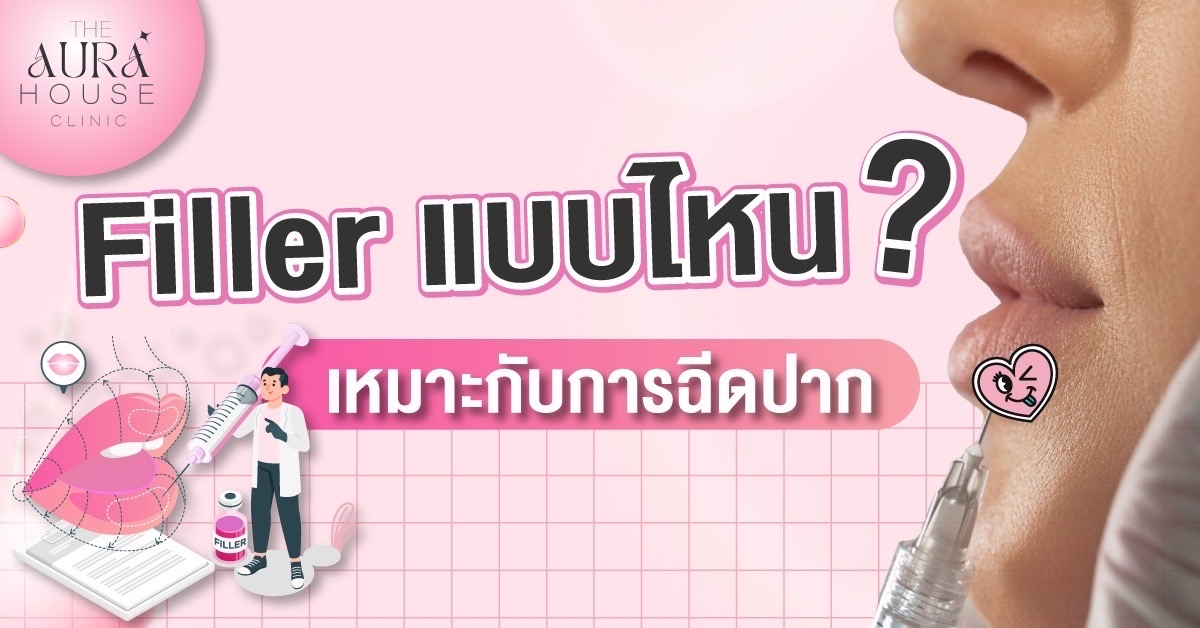 ข่าวความงาม - Filler แบบไหนเหมาะกับการฉีดปาก