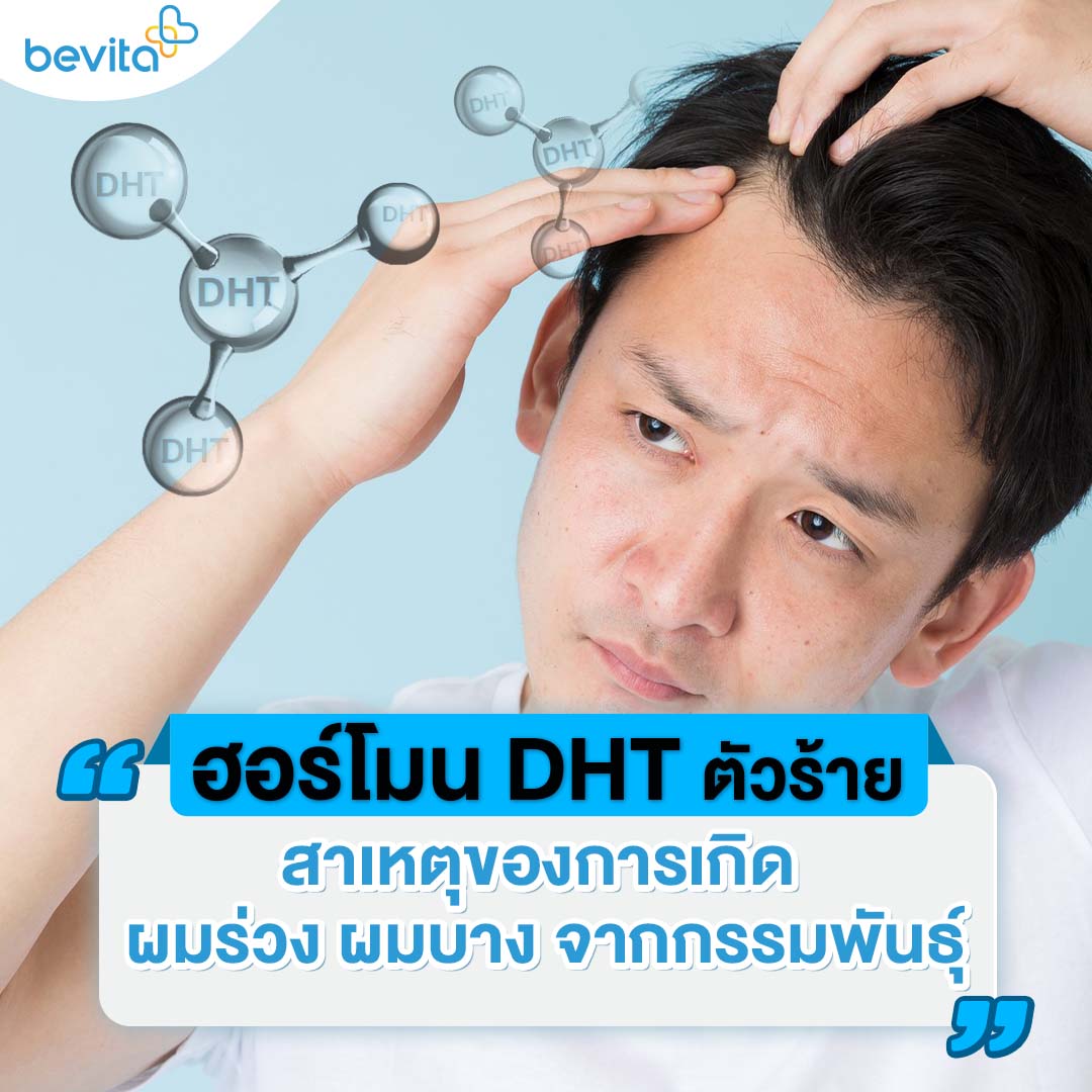 ข่าวสุขภาพ - ฮอร์โมน DHT ตัวร้าย สาเหตุของการเกิดผมร่วง ผมบาง จากกรรมพันธุ์