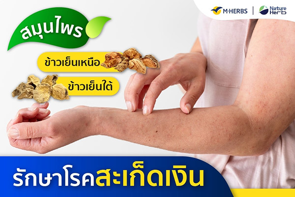 ข่าวประชาสัมพันธ์ - PR News สมุนไพรข้าวเย็นเหนือ ข้าวเย็นใต้ รักษาโรคสะเก็ดเงิน