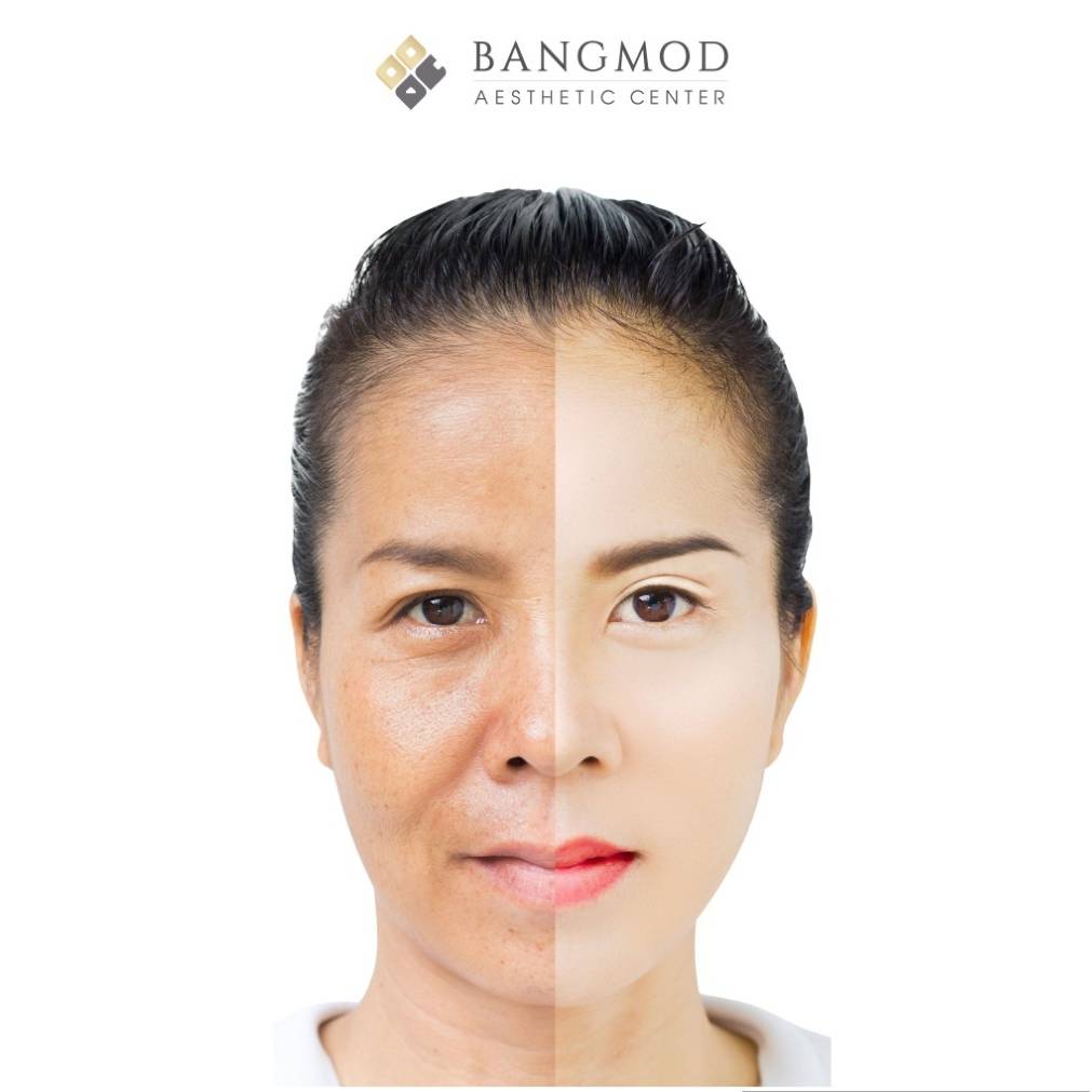 ข่าวความงาม - ผ่าตัดดึงหน้าควบคู่การดูแลผิวหน้า ดึงเอกลักษณ์เฉพาะ ในแบบที่เป็นคุณ