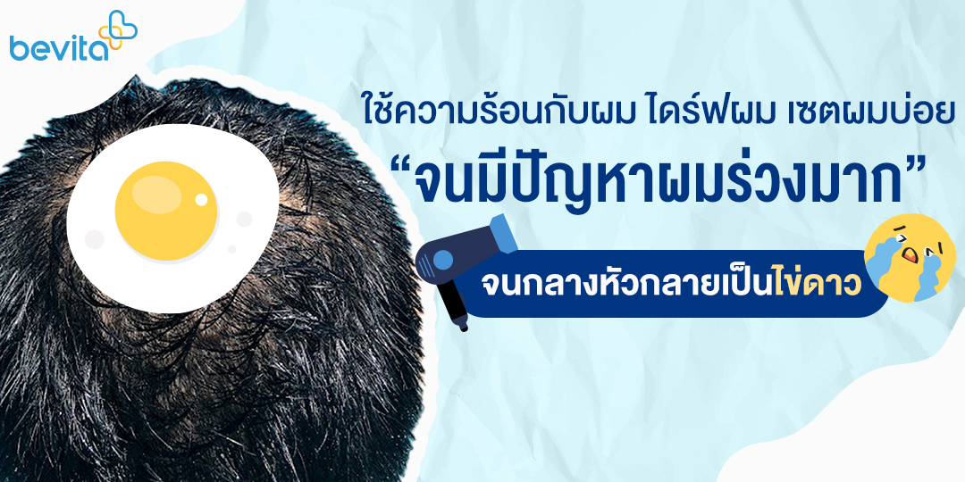 ข่าวสุขภาพ - ใครมีปัญหาหัวล้านจนเป็นไข่ดาวตรงกลางหัวบ้าง?