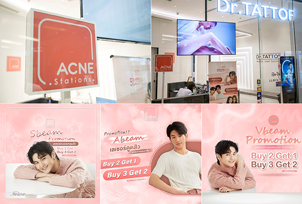 ข่าวความงาม - Acne Stations สเตชั่นรักษาสิวด้วยเลเซอร์ ดูแลทุกปัญหาสิวโดยผู้เชี่ยวชาญ โปรโมชั่นฉลองเปิดตัวใหม่