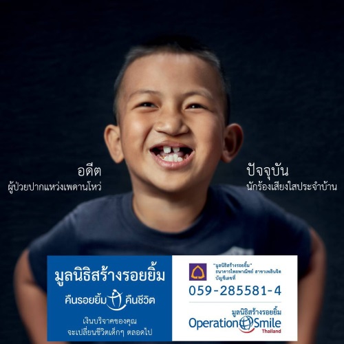 มูลนิธิสร้างรอยยิ้ม (Operation Smile Foundation)