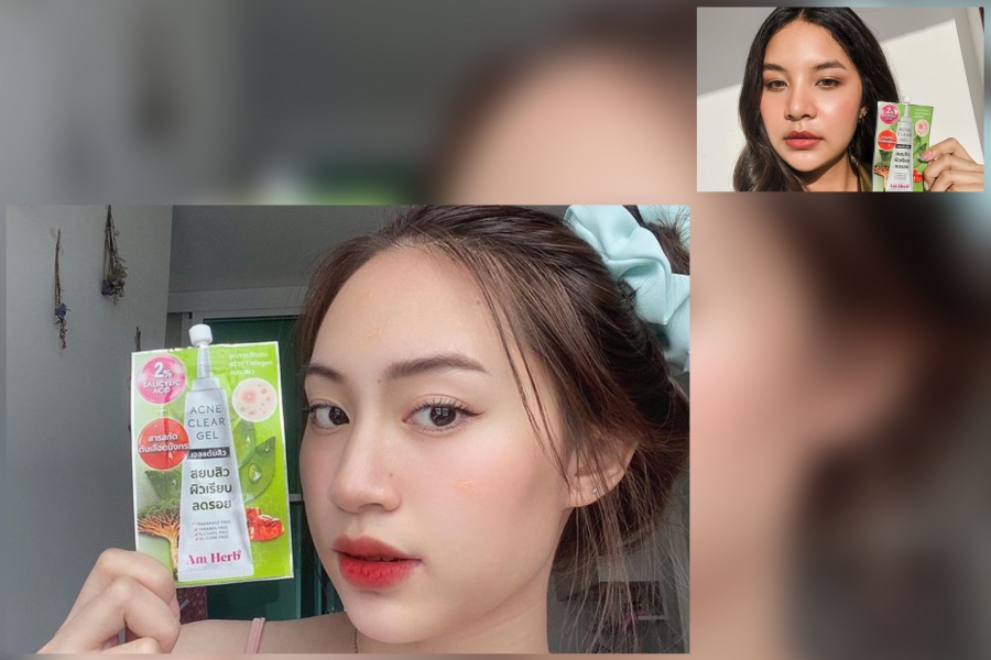 AM HERB แอคเน่ เคลียร์ เจล : สิวยุบไวไร้ร่องรอย วันนี้ท้าให้คุณสาว ๆ ได้ทดลอง