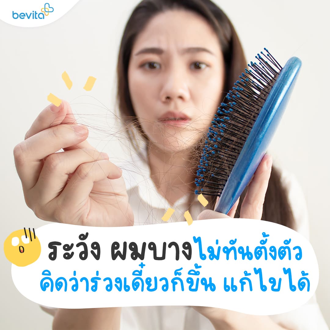 ข่าวสุขภาพ - หนุ่มสาวหลายๆคน มักจะเข้าใจว่า ?ผมร่วง? เป็นเรื่องธรรมชาติที่ทุกคนต้องเจอ  แต่ใครจะไปรู้ว่านั่นเป็นสัญญาณเตือนแรกของการเริ่มมีปัญหาผม